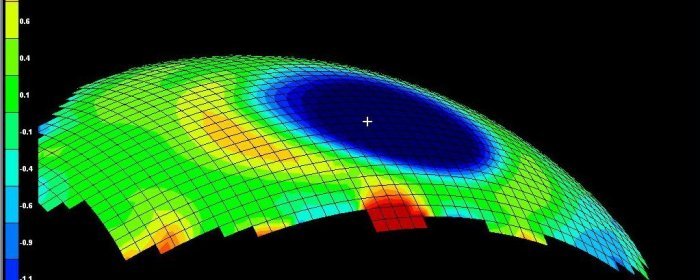Orthokeratology research 